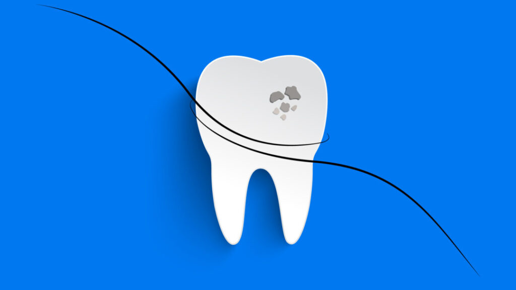 Researchers Develop Hair Protein Toothpaste to Replace Fillings ...